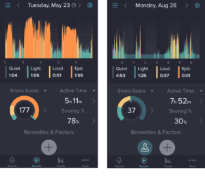 Snorelab, hulp bij afstellen