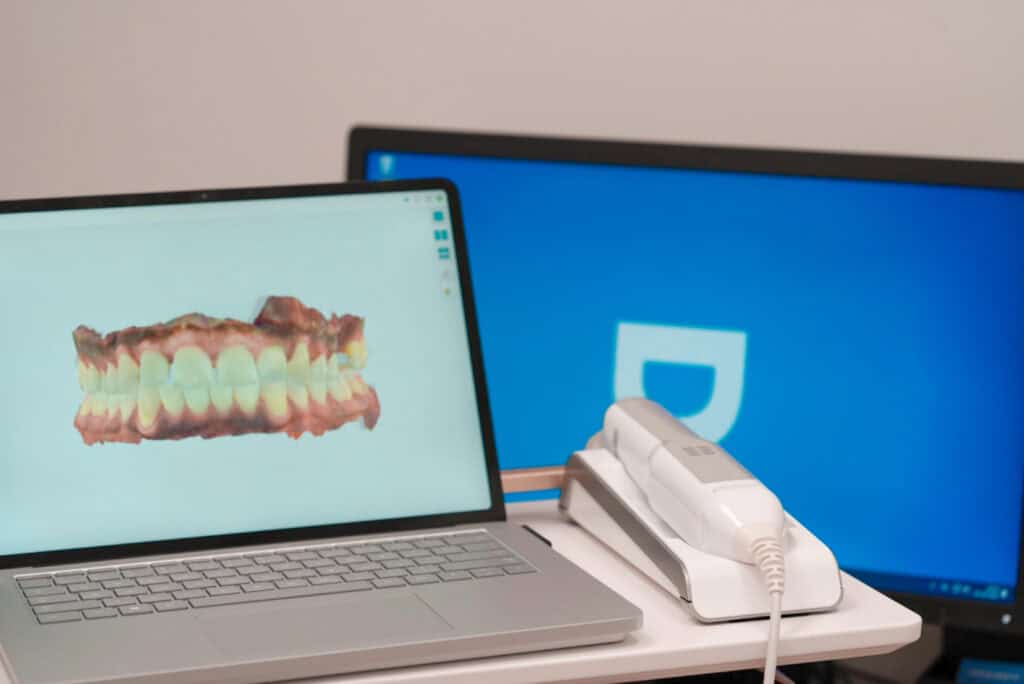 Scannen van onzichtbare beugel